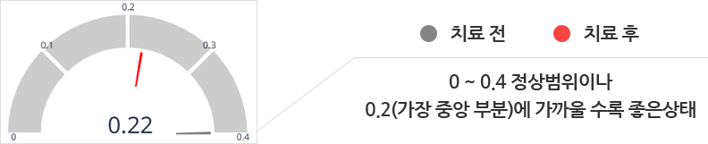 치료 전후 게이지