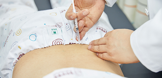Bee Venom Acupuncture